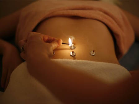 moxibustion Treatment